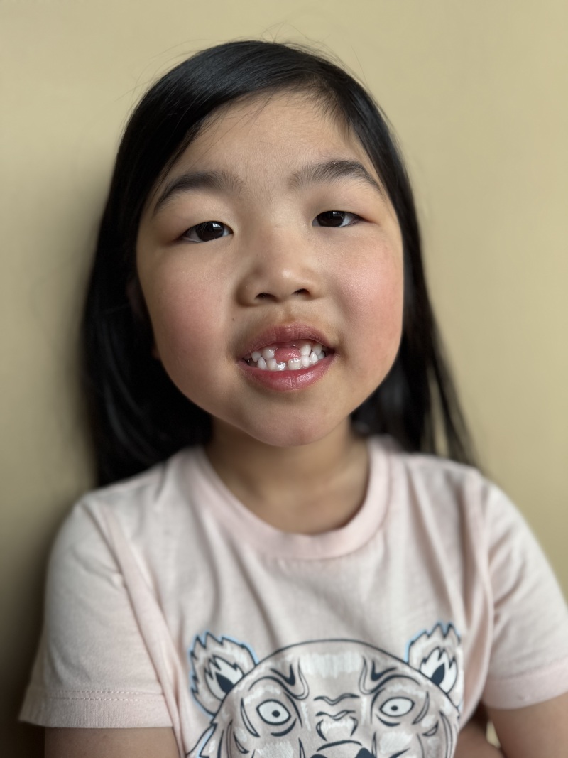 ZAZA Casting model ID: 26072