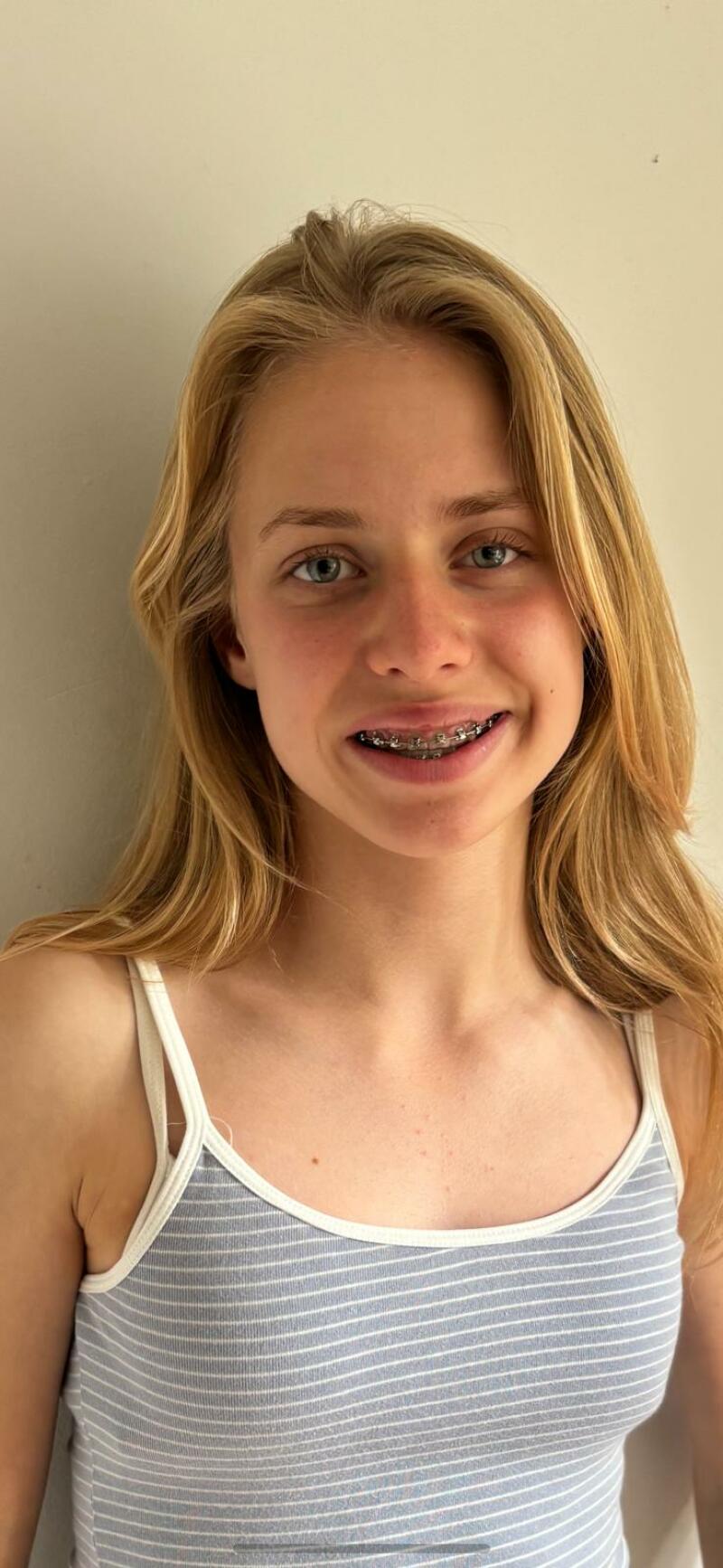ZAZA Casting model ID: 25675