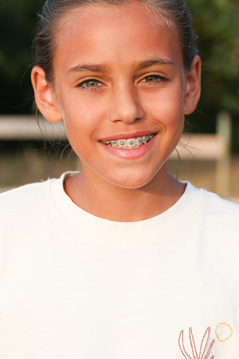 ZAZA Casting model ID: 2532