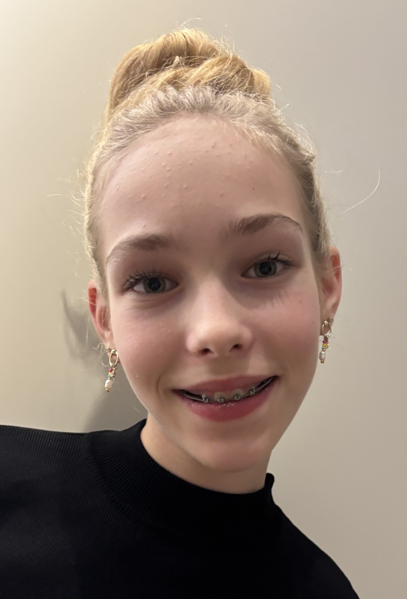 ZAZA Casting model ID: 14456