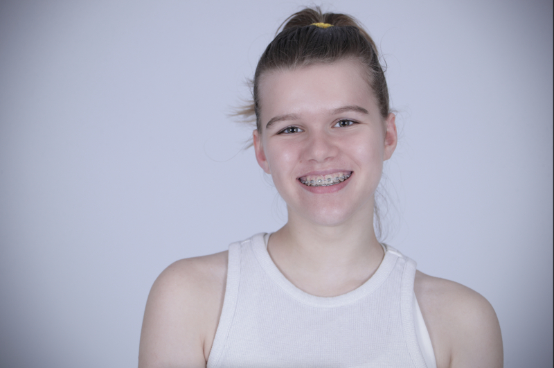 ZAZA Casting model ID: 18274