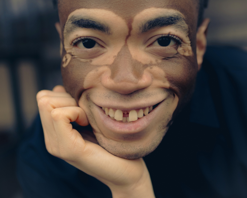 ZAZA Casting model ID: 17917