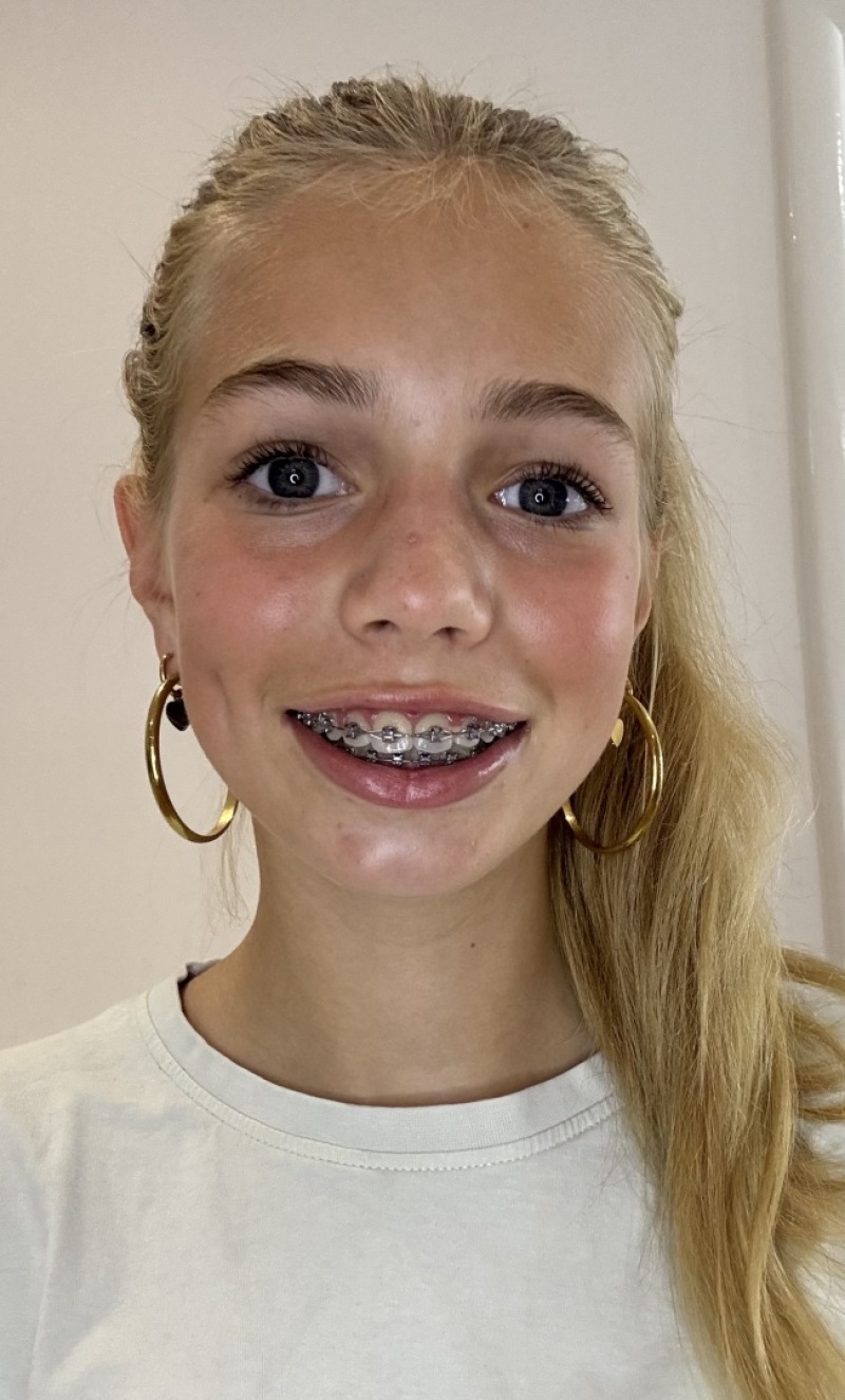 ZAZA Casting model ID: 25297