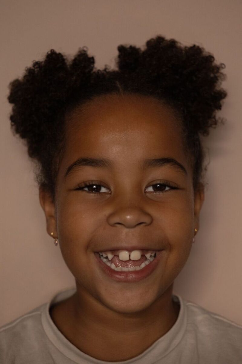 ZAZA Casting model ID: 25551